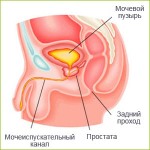 Признаки простатита у мужчин